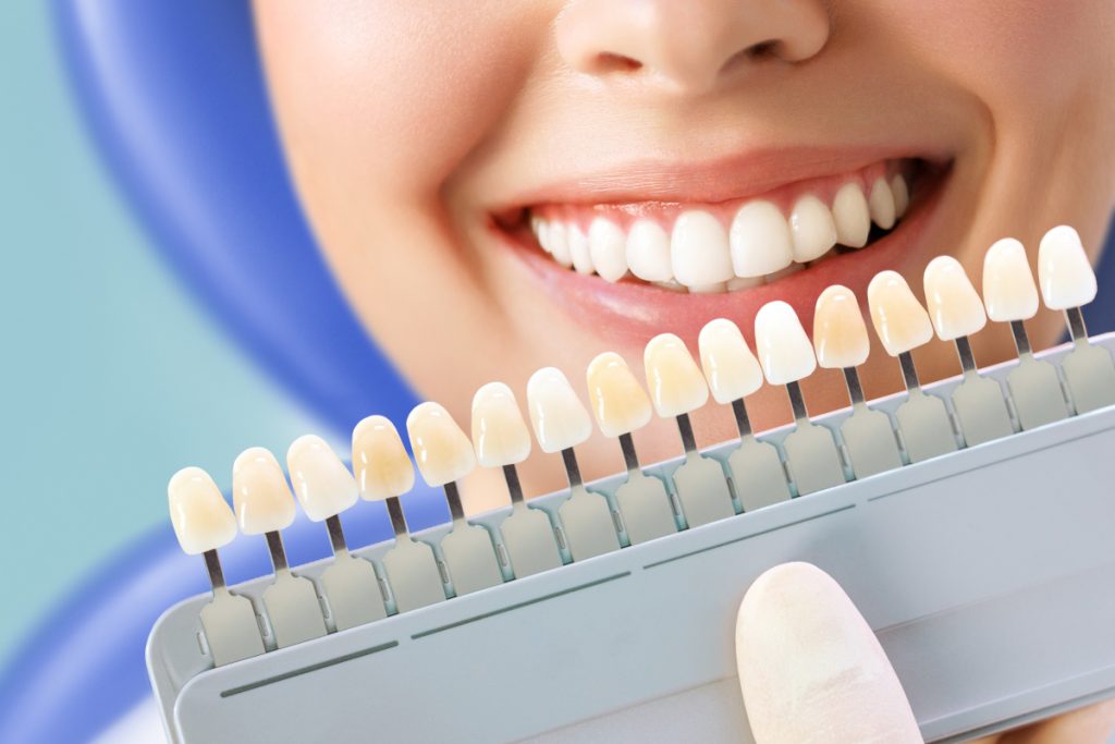 .Cosmetological teeth whitening